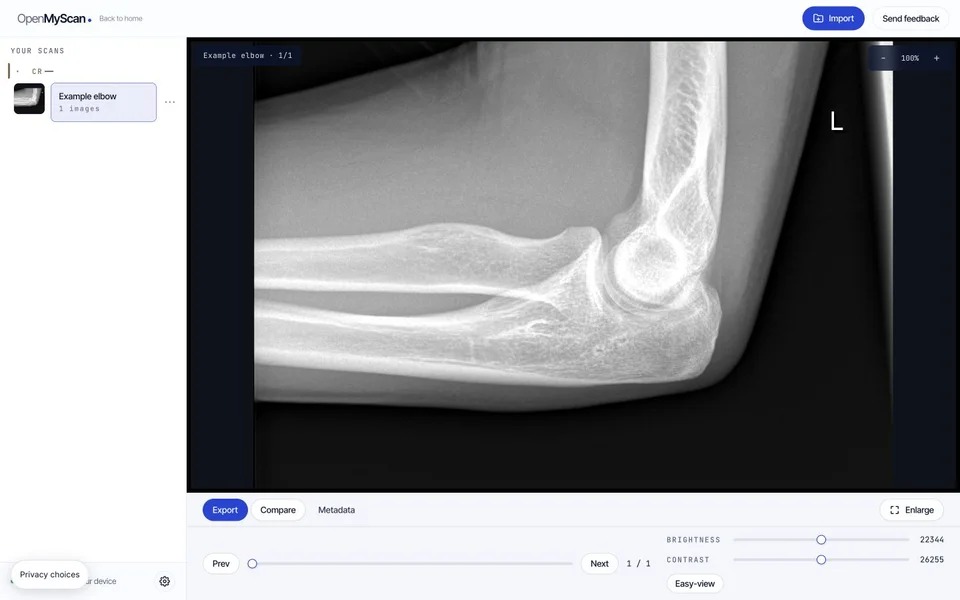 An elbow X-ray open in OpenMyScan, with the series list and image controls visible