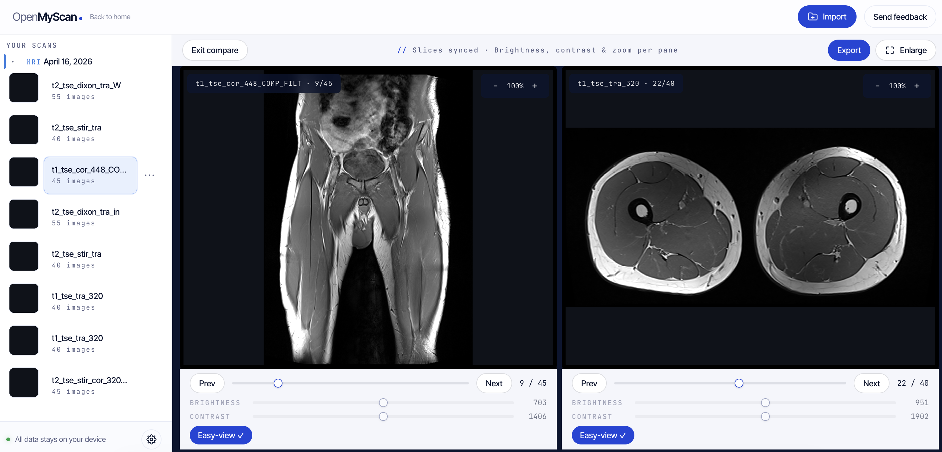 OpenMyScan zeigt eine MRT-Schicht mit Scrubber und Window/Level-Reglern