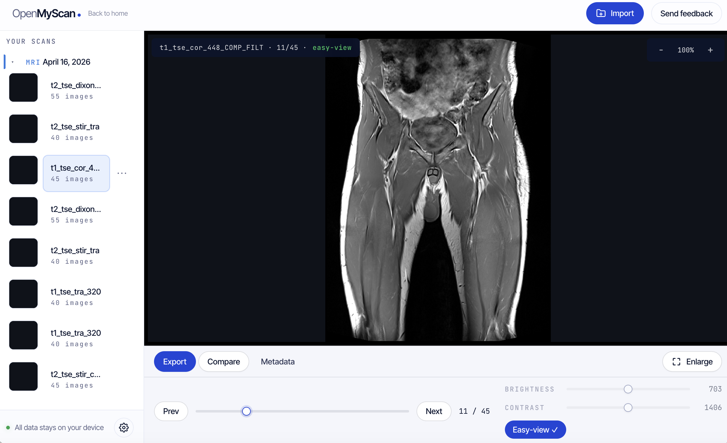 OpenMyScan viewer showing an MRI series with sidebar navigation and brightness controls